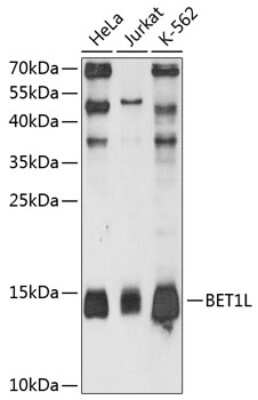 Western Blot: BET1L Antibody [NBP2-92050] - Analysis of extracts of various cell lines, using BET1L .Exposure time: 90s.