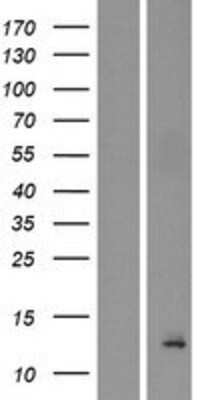 Western Blot: BET1L Overexpression Lysate (Adult Normal) [NBP2-04357] Left-Empty vector transfected control cell lysate (HEK293 cell lysate); Right -Over-expression Lysate for BET1L.