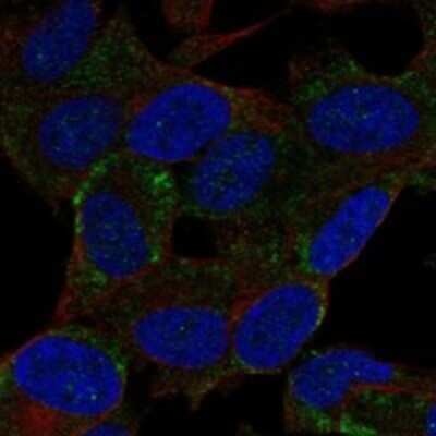 Immunocytochemistry/Immunofluorescence: BEX2 Antibody [NBP3-17569] - Staining of human cell line SH-SY5Y shows localization to cytosol.