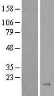 Western Blot BEX5 Overexpression Lysate