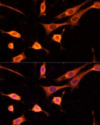 Immunocytochemistry/Immunofluorescence: BFAR Antibody [NBP2-92687] - Analysis of NIH-3T3 cells using BFAR . Blue: DAPI for nuclear staining.