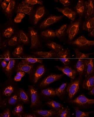 Immunocytochemistry/Immunofluorescence: BFAR Antibody [NBP2-92687] - Analysis of U-2 OS cells using BFAR . Blue: DAPI for nuclear staining.