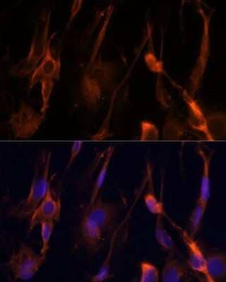 Immunocytochemistry/Immunofluorescence: BFAR Antibody [NBP2-92687] - Immunofluorescence analysis of C6 cells using BFAR Polyclonal Antibody (NBP2-92687) at dilution of 1:100 (40x lens). Blue: DAPI for nuclear staining.