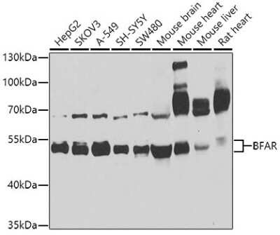 Western Blot: BFAR Antibody [NBP2-92687] - Analysis of extracts of various cell lines, using BFAR at 1:1000 dilution.Secondary antibody: HRP Goat Anti-Rabbit IgG (H+L) at 1:10000 dilution.Lysates/proteins: 25ug per lane.Blocking buffer: 3% nonfat dry milk in TBST.Detection: ECL Basic Kit .Exposure time: 1s.