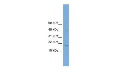 Western Blot: BHLHA9 Antibody [NBP2-82749] - WB Suggested Anti-A830053O21Rik Antibody Titration: 0.2-1 ug/ml. Positive Control: Mouse Brain