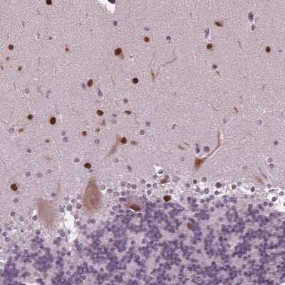 Immunohistochemistry: BHLHB5 Antibody [NBP2-39085] - Staining of human cerebellum shows strong nuclear positivity in cells in molecular layer.