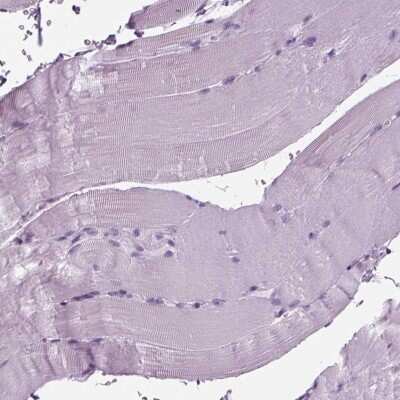 Immunohistochemistry-Paraffin BHLHB5 Antibody