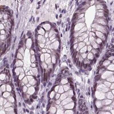 Immunohistochemistry-Paraffin: BHLHB5 Antibody [NBP2-39085] - Staining of human colon.
