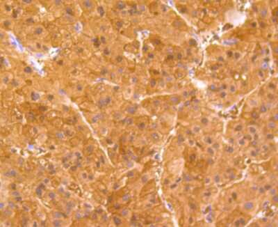 Immunohistochemistry-Paraffin: BHMT Antibody (9E1) [NBP2-75418] - Analysis of paraffin-embedded human liver tissue using anti-BHMT antibody. Counter stained with hematoxylin.
