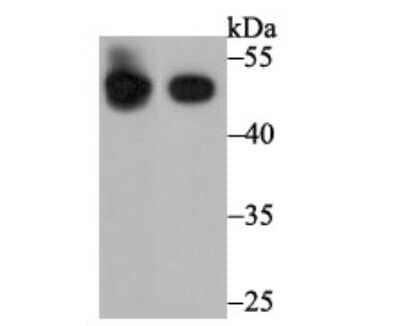 Western Blot: BHMT Antibody (9E1) [NBP2-75418] - Analysis of BHMT on human liver tissue and human kidney tissue lysate using anti-BHMT antibody at 1/1,000 dilution.