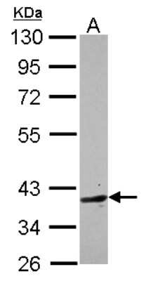 Western Blot: BHMT2 Antibody [NBP2-15585] - Sample (30 ug of whole cell lysate) A: HCT116 10% SDS PAGE gel, diluted at 1:1000.