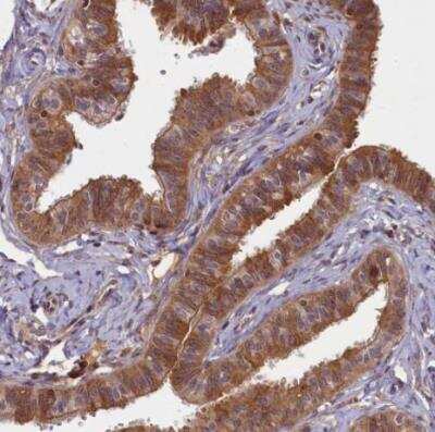 Immunohistochemistry-Paraffin: BICD1 Antibody [NBP1-85843] - Staining of human fallopian tube shows strong granular cytoplasmic positivity in glandular cells.
