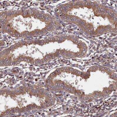 Immunohistochemistry-Paraffin: BICD1 Antibody [NBP1-85843] - Staining of human endometrium shows moderate granular cytoplasmic positivity in glandular cells. 