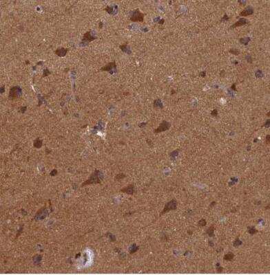 Immunohistochemistry-Paraffin: BICD1 Antibody [NBP1-85843] - Staining of human cerebral cortex shows strong granular cytoplasmic positivity in neurons.