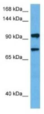 Western Blot: BICD1 Antibody [NBP3-10679] - Western blot analysis of BICD1 in Human Thymus Tumor lysates. Antibody dilution at 1ug/ml