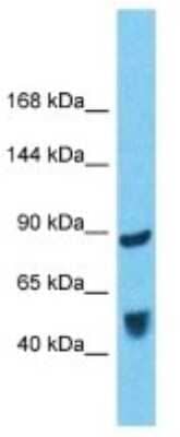 Western Blot: BICD1 Antibody [NBP3-10778] - Western blot analysis of BICD1 in Fetal Liver lysates. Antibody dilution at 1.0ug/ml