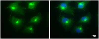 Immunocytochemistry/Immunofluorescence: BICD2 Antibody (10811) [NBP2-43683] - Sample: HeLa cells were fixed in 4% paraformaldehyde for 10 min. Green: BICD2 protein stained by BICD2 antibody diluted at 1:100. Blue: Hoechst 33342 staining. Scale bar = 10 um.