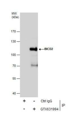 Immunoprecipitation: BICD2 Antibody (10811) [NBP2-43683] - Immunoprecipitation of BICD2 protein from A431 whole cell extracts using 5 ug of BICD2 antibody. Western blot analysis was performed using BICD2 antibody. EasyBlot anti-Mouse IgG was used as a secondary reagent.