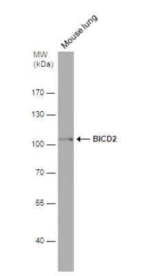 Western Blot: BICD2 Antibody (10811) [NBP2-43683] - Mouse tissue extract (50 ug) was separated by 7.5% SDS-PAGE, and the membrane was blotted with BICD2 antibody diluted at 1:1000.