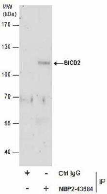 Immunoprecipitation: BICD2 Antibody (1824) [NBP2-43684] - Analysis of BICD2 protein from A431 whole cell extracts using 5 ug of BICD2 antibody [1824]. Western blot analysis was performed using BICD2 antibody [1824]. EasyBlot anti-Mouse IgG was used as a secondary reagent.