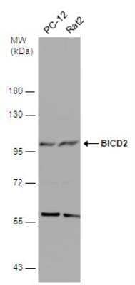 Western Blot: BICD2 Antibody (1824) [NBP2-43684] - Various whole cell extracts (30 ug) were separated by 7.5% SDS-PAGE, and the membrane was blotted with BICD2 antibody [GT1824].