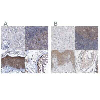 Immunohistochemistry-Paraffin: BICD2 Antibody [NBP1-81488] - Staining of human liver, lymph node, skin and testis using Anti-BICD2 antibody NBP1-81488 (A) shows similar protein distribution across tissues to independent antibody NBP1-81489 (B).