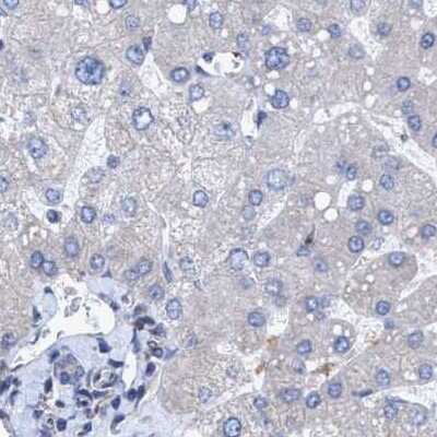Immunohistochemistry-Paraffin: BICD2 Antibody [NBP1-81488] - Staining of human liver using Anti-BICD2 antibody NBP1-81488.