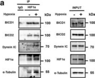 Western Blot: BICD2 Antibody [NBP1-81488] - Role of BICD1 in dynein-mediated HIF1alpha nuclear translocation in UCB-MSCs. Co-immunoprecipitation of BICD1, BICD2, Dynein IC, and alpha-Tubulin with IgG and HIF1alpha antibodies were shown in left panel. Total protein expressions in lysate were shown in right panel. n = 3. *p < 0.05 vs. normoxia control. Image collected and cropped by CiteAb from the following publication (//www.nature.com/articles/s41418-018-0241-1), licensed under a CC-BY license.