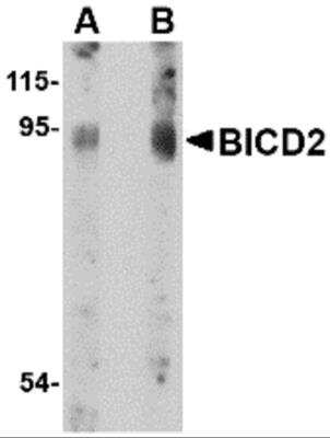 Western Blot: BICD2 Antibody [NBP2-81955] - Analysis of BICD2 in A549 cell lysate with BICD2 antibody at (A) 1 and (B) 2 ug/ml.