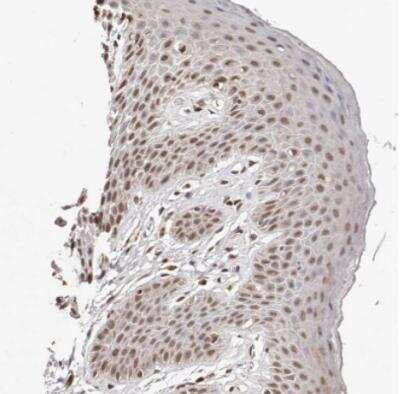 Immunohistochemistry-Paraffin: BICRAL Antibody [NBP1-86360] - Staining of human skin shows moderate nuclear positivity in squamous epithelial cells. 