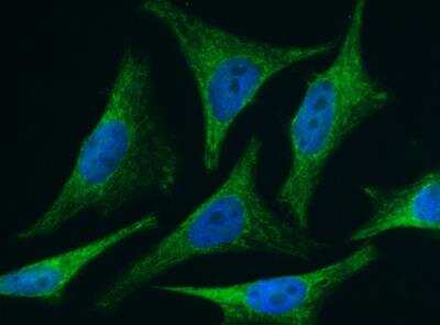 Immunocytochemistry/Immunofluorescence: BID Antibody (005) [NBP2-89516] - Staining of Human BID in Hela cells. Cells were fixed with 4% PFA, permeabilzed with 0.3% Triton X-100 in PBS, blocked with 10% serum, and incubated with rabbit anti-Human BID monoclonal antibody (1:60) at 37c 1 hour. Then cells were stained with the Alexa Fluor(R) 488-conjugated Goat Anti-rabbit IgG secondary antibody (green) and counterstained with DAPI (blue). Positive staining was localized to cytoplasm.