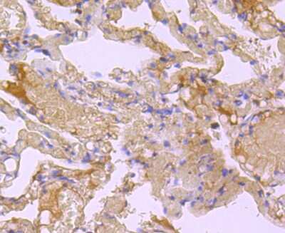 Immunohistochemistry-Paraffin: BID Antibody (JM11-14) [NBP2-67190] - Analysis of paraffin-embedded human lung tissue using anti-Bid antibody. Counter stained with hematoxylin.