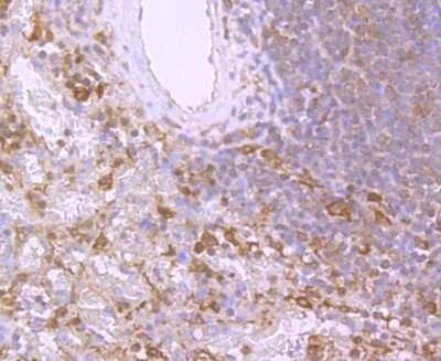 Immunohistochemistry-Paraffin: BID Antibody (JM11-14) [NBP2-67190] - Analysis of paraffin-embedded human spleen tissue using anti-Bid antibody. Counter stained with hematoxylin.