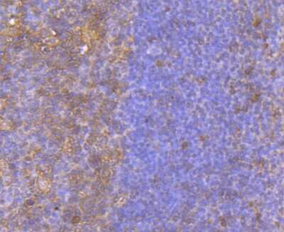 Immunohistochemistry-Paraffin: BID Antibody (JM11-14) [NBP2-67190] - Analysis of paraffin-embedded human tonsil tissue using anti-Bid antibody. Counter stained with hematoxylin.