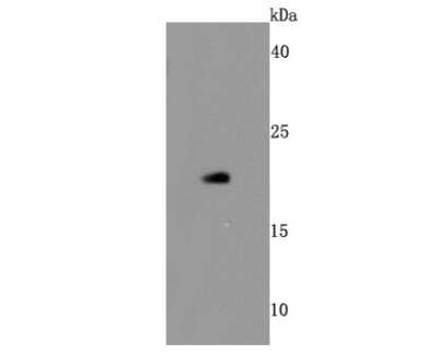 Immunohistochemistry-Paraffin: BID Antibody (JM11-14) [NBP2-67190] - Analysis of Bid on human thymus tissue lysates using anti-Bid antibody at 1/500 dilution.