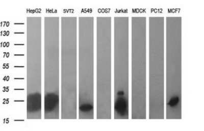 Western Blot: BID Antibody (OTI1G10) - Azide and BSA Free [NBP2-70254] - Analysis of extracts (35ug) from 9 different cell lines (HepG2: human; HeLa: human; SVT2: mouse; A549: human; COS7: monkey; Jurkat: human; MDCK: canine; PC12: rat; MCF7: human).