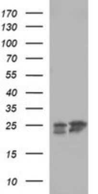 Western Blot: BID Antibody (OTI1G10) - Azide and BSA Free [NBP2-70254] - Analysis of HEK293T cells were transfected with the pCMV6-ENTRY control (Left lane) or pCMV6-ENTRY BID.