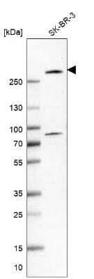 Western Blot: BIG3 Antibody [NBP1-90759] - Analysis in human cell line SK-BR-3.