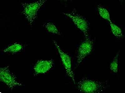 Immunocytochemistry/Immunofluorescence: BIK Antibody [NBP2-98984] - Immunofluorescence staining of BIK in HeLa cells. Cells were fixed with 4% PFA, permeabilzed with 0.3% Triton X-100 in PBS, blocked with 10% serum, and incubated with rabbit anti-human BIK polyclonal antibody (dilution ratio: 1:1000) at 4C overnight. Then cells were stained with the Alexa Fluor(R)488-conjugated Goat Anti-rabbit IgG secondary antibody (green).Positive staining was localized to cytoplasm and nucleus.