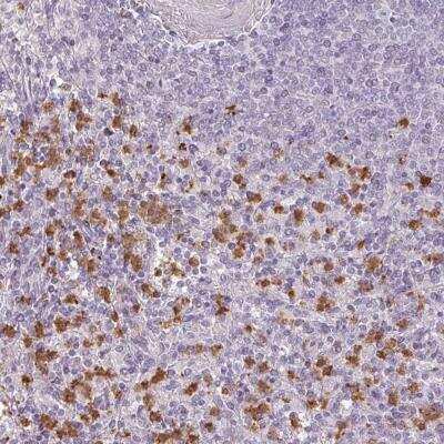 Immunohistochemistry-Paraffin: BIK Antibody [NBP2-33612] - Staining of human spleen shows strong cytoplasmic positivity in cells in red pulp.