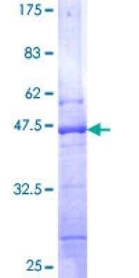 SDS-PAGE Recombinant Human BIK GST (N-Term) Protein