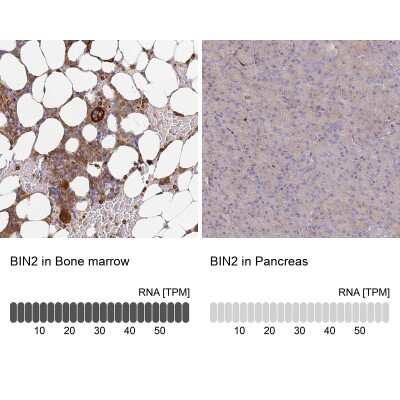 Immunohistochemistry-Paraffin: BIN2 Antibody [NBP2-48690] - Staining in human bone marrow and pancreas tissues using anti-BIN2 antibody. Corresponding BIN2 RNA-seq data are presented for the same tissues.