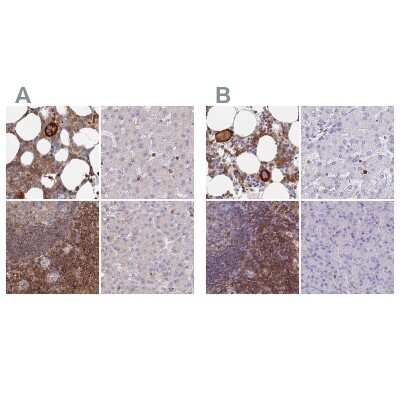 <b>Independent Antibodies Validation and Orthogonal Strategies Validation.</b>Immunohistochemistry-Paraffin: BIN2 Antibody [NBP2-48690] - Staining of human bone marrow, liver, lymph node and pancreas using Anti-BIN2 antibody NBP2-48690 (A) shows similar protein distribution across tissues to independent antibody NBP2-48691 (B).