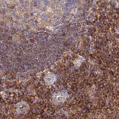 Immunohistochemistry-Paraffin: BIN2 Antibody [NBP2-48690] - Staining of human lymph node.