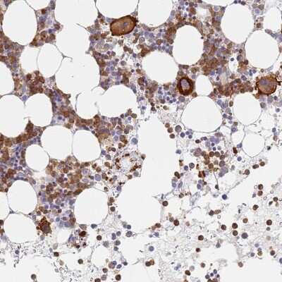 Immunohistochemistry-Paraffin: BIN2 Antibody [NBP2-48691] - Staining of human bone marrow shows high expression.