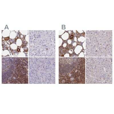 <b>Independent Antibodies Validation. </b>Immunohistochemistry-Paraffin: BIN2 Antibody [NBP2-48691] - Staining of human bone marrow, liver, lymph node and pancreas using Anti-BIN2 antibody NBP2-48691 (A) shows similar protein distribution across tissues to independent antibody NBP2-48690 (B).