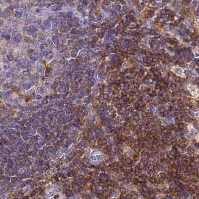 Immunohistochemistry-Paraffin: BIN2 Antibody [NBP2-48691] - Staining of human lymph node.