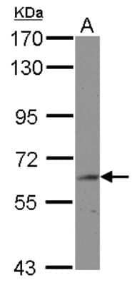 Western Blot: BIN2 Antibody [NBP2-15588] - Sample (30 ug of whole cell lysate) A: HepG2 10% SDS PAGE gel, diluted at 1:1000.