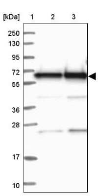 Western Blot: BIN2 Antibody [NBP2-48690] - Lane 1: Marker [kDa] 250, 130, 95, 72, 55, 36, 28, 17, 10Lane 2: Human cell line RT-4Lane 3: Human cell line U-251MG sp