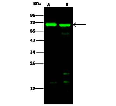 Western Blot: BIN2 Antibody [NBP2-97015] - Anti-BIN2 rabbit polyclonal antibody at 1:500 dilution. Lane A: A549 Whole Cell Lysate. Lane B: HepG2 Whole Cell Lysate. Lysates/proteins at 30 ug per lane. Secondary Goat Anti- Rabbit  IgG H&L (Dylight 800)  at 1/10000 dilution. Developed using the Odyssey technique. Performed under reducing conditions. Predicted band size: 62 kDa. Observed band size: 62 kDa (We are unsure as to the identity of these extra bands).